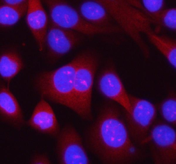 Immunofluorescent staining of RPL14 using anti-RPL14 antibody (red). RPL14 was detected in an immunocytochemical section of HELA cells. Enzyme antigen retrieval was performed using IHC enzyme antigen retrieval reagent for 15 mins. The cells were blocked with 10% goat serum. And then incubated with 5 ug/ml rabbit anti-RPL14 antibody overnight at 4oC. Cy3 Conjugated Goat Anti-Rabbit IgG was used as secondary antibody at 1:500 dilution and incubated for 30 minutes at 37oC. The section was counterstained with DAPI nuclear stain (blue). Visualize using a fluorescence microscope and filter sets appropriate for the label used.