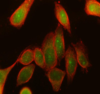 Immunofluorescent staining of RPS6KA3 using anti-RPS6KA3 antibody (green) and anti-Beta Tubulin antibody (red). RPS6KA3 was detected in immunocytochemical section of SiHa cell. Enzyme antigen retrieval was performed using IHC enzyme antigen retrieval reagent for 15 mins. The cells were blocked with 10% goat serum. And then incubated with 5 ug/ml rabbit anti-RPS6KA3 antibody and mouse anti-Beta Tubulin antibody overnight at 4oC. DyLight 488 Conjugated Goat Anti-Rabbit IgG and DyLight 594 Conjugated Goat Anti-Mouse IgG were used as secondary antibody at 1:500 dilution and incubated for 30 minutes at 37oC. Visualize using a fluorescence microscope and filter sets appropriate for the label used.