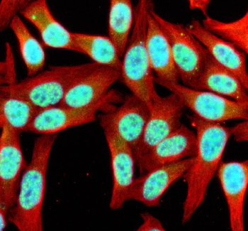 Immunofluorescent staining of SIK1 using anti-SIK1 antibody (green) and anti-Beta Tubulin antibody (red). SIK1 was detected in an immunocytochemical section of Hela cells. Enzyme antigen retrieval was performed using IHC enzyme antigen retrieval reagent for 15 mins. The cells were blocked with 10% goat serum. And then incubated with 5 ug/ml rabbit anti-SIK1 antibody and mouse anti-Beta Tubulin antibody overnight at 4oC. DyLight 488 Conjugated Goat Anti-Rabbit IgG and Cy3 Conjugated Goat Anti-Mouse IgG were used as secondary antibody at 1:500 dilution and incubated for 30 minutes at 37oC. The section was counterstained with DAPI nuclear stain (blue). Visualize using a fluorescence microscope and filter sets appropriate for the label used.
