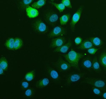 Immunofluorescent staining of SCD using anti-SCD1 antibody (green). SCD1 was detected in an immunocytochemical section of cells. Enzyme antigen retrieval was performed using IHC enzyme antigen retrieval reagent for 15 mins. The cells were blocked with 10% goat serum. And then incubated with 5 ug/ml rabbit anti-SCD1 antibody overnight at 4oC. DyLight 488 Conjugated Goat Anti-Rabbit IgG was used as secondary antibody at 1:500 dilution and incubated for 30 minutes at 37oC. The section was counterstained with DAPI nuclear stain (blue). Visualize using a fluorescence microscope and filter sets appropriate for the label used.