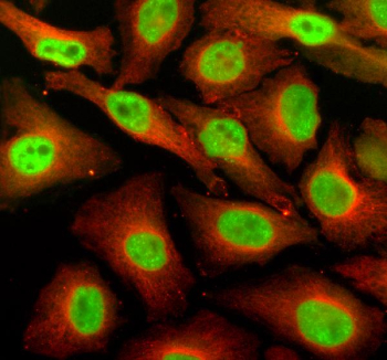 Immunofluorescent staining of SUPT16H using anti-SUPT16H antibody (green) and anti-Beta Tubulin antibody (red). SUPT16H was detected in an immunocytochemical section of Hela cells. Enzyme antigen retrieval was performed using IHC enzyme antigen retrieval reagent for 15 mins. The cells were blocked with 10% goat serum. And then incubated with 5 ug/ml rabbit anti-SUPT16H antibody and mouse anti-Beta Tubulin antibody overnight at 4oC. DyLight 488 Conjugated Goat Anti-Rabbit IgG and Cy3 Conjugated Goat Anti-Mouse IgG were used as secondary antibody at 1:500 dilution and incubated for 30 minutes at 37oC. Visualize using a fluorescence microscope and filter sets appropriate for the label used.