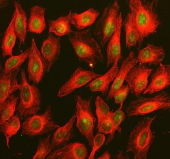 Immunofluorescent staining of BOP1 using anti-BOP1 antibody (green) and anti-Beta Tubulin antibody (red). BOP1 was detected in an immunocytochemical section of U2OS cells. Enzyme antigen retrieval was performed using IHC enzyme antigen retrieval reagent for 15 mins. The cells were blocked with 10% goat serum. And then incubated with 5 ug/ml rabbit anti-BOP1 antibody and mouse anti-Beta Tubulin antibody overnight at 4oC. DyLight 488 Conjugated Goat Anti-Rabbit IgG and DyLight 594 Conjugated Goat Anti-Mouse IgG were used as secondary antibody at 1:500 dilution and incubated for 30 minutes at 37oC. Visualize using a fluorescence microscope and filter sets appropriate for the label used.