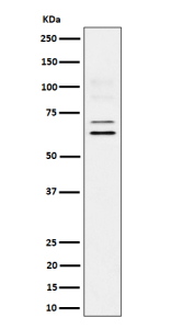 Western blot analysis of BIN1 expression in human U87-MG cell lysate. BIN1 (~65 kDa predicted) was detected as multiple bands at ~65 and ~70 kDa, with faint higher species near ~100 kDa, consistent with known tissue-specific splice variants and post-translationally modified BIN1 isoforms.