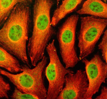 Immunofluorescent staining of TFEC using anti-TFEC antibody (green) and anti-Beta Tubulin antibody (red). TFEC was detected in an immunocytochemical section of U2OS cells. Enzyme antigen retrieval was performed using IHC enzyme antigen retrieval reagent for 15 mins. The cells were blocked with 10% goat serum. And then incubated with 5 ug/ml rabbit anti-TFEC antibody and mouse anti-Beta Tubulin antibody overnight at 4oC. DyLight 488 Conjugated Goat Anti-Rabbit IgG and Cy3 Conjugated Goat Anti-Mouse IgG were used as secondary antibody at 1:500 dilution and incubated for 30 minutes at 37oC. Visualize using a fluorescence microscope and filter sets appropriate for the label used.