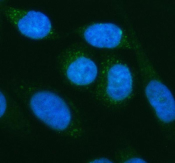 Immunofluorescent staining of MFSD2A using anti-MFSD2A antibody (green). MFSD2A was detected in an immunocytochemical section of SIHA cells. Enzyme antigen retrieval was performed using IHC enzyme antigen retrieval reagent for 15 mins. The cells were blocked with 10% goat serum. And then incubated with 5 ug/ml rabbit anti-MFSD2A antibody overnight at 4oC. DyLight 488 Conjugated Goat Anti-Rabbit IgG was used as secondary antibody at 1:500 dilution and incubated for 30 minutes at 37oC. The section was counterstained with DAPI nuclear stain (blue). Visualize using a fluorescence microscope and filter sets appropriate for the label used.
