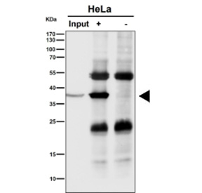 Immunoprecipitation analysis using the NMI antibody at 1:50 dilution (Western blot at 1:1000 dilution). Predicted molecular weight ~35 kDa.