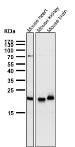 All lanes use the TIMM22 antibody at 1:2000 dilution for 1 hour at room temperature. Predicted molecular weight ~20 kDa.
