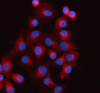 Immunofluorescent staining of FFPE human A549 cells with SCAMP3 antibody (red) and DAPI nuclear stain (blue). HIER: steam section in pH6 citrate buffer for 20 min.