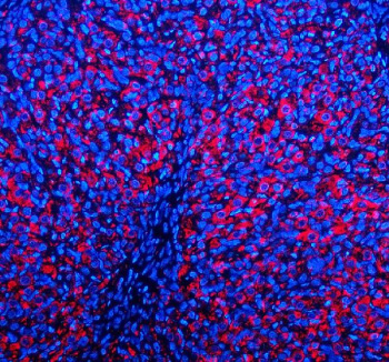 Immunofluorescent staining of EMC1 using anti-EMC1 antibody (red). EMC1 was detected in a paraffin-embedded section of rat ovary tissue. Heat mediated antigen retrieval was performed in EDTA buffer (pH 8.0, epitope retrieval solution). The tissue section was blocked with 10% goat serum. The tissue section was then incubated with 5 ug/ml rabbit anti-EMC1 antibody overnight at 4oC. Cy3 Conjugated Goat Anti-Rabbit IgG was used as secondary antibody at 1:500 dilution and incubated for 30 minutes at 37oC. The section was counterstained with DAPI nuclear stain (blue). Visualize using a fluorescence microscope and filter sets appropriate for the label used.