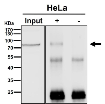 Immunoprecipitation analysis using the antibody at 1:50 dilution. Western blot probed with anti-BRAT1 shows a major band at ~75 kDa, lower than the predicted ~88 kDa, consistent with the known anomalous migration of BRAT1 due to its compact structure and partial N-terminal processing.
