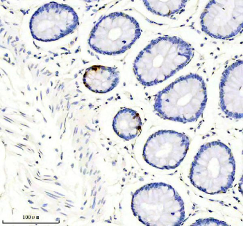 Somatostatin 28 Antibody. Immunohistochemistry analysis of formalin-fixed, paraffin-embedded mouse pancreas tissue using a rabbit Somatostatin 28 antibody. Heat-induced antigen retrieval was performed in EDTA buffer at pH 8.0. The section was blocked with goat serum and incubated with primary antibody overnight at 4oC, followed by a peroxidase-conjugated goat anti-rabbit IgG secondary antibody. Cytoplasmic HRP-DAB brown staining is observed in islet cells within pancreatic tissue, consistent with Somatostatin 28 expression in endocrine cell populations.