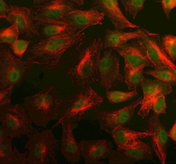 Immunofluorescent staining of PSME4 using anti-PSME4 antibody (green) and anti-Beta Tubulin antibody (red). PSME4 was detected in an immunocytochemical section of cells. Enzyme antigen retrieval was performed using IHC enzyme antigen retrieval reagent for 15 mins. The cells were blocked with 10% goat serum. And then incubated with 5 ug/ml rabbit anti-PSME4 antibody and mouse anti-Beta Tubulin antibody overnight at 4oC. DyLight 488 Conjugated Goat Anti-Rabbit IgG and Cy3 Conjugated Goat Anti-Mouse IgG were used as secondary antibody at 1:500 dilution and incubated for 30 minutes at 37oC. Visualize using a fluorescence microscope and filter sets appropriate for the label used.