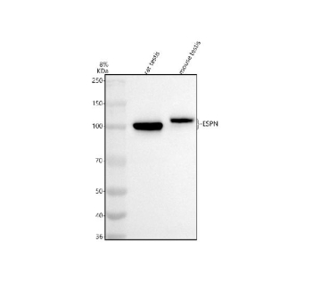 Western blot analysis of ESPN using anti-ESPN antibody. Electrophoresis was performed on a 8% SDS-PAGE gel at 80V (Stacking gel) / 120V (Resolving gel) for 2 hours. Lane 1: rat testis tissue lysates, Lane 2: mouse testis tissue lysates. After electrophoresis, proteins were transferred to a nitrocellulose membrane at 150 mA for 50-90 minutes. Blocked the membrane with 5% non-fat milk/TBS for 1.5 hour at RT. The membrane was incubated with rabbit anti-ESPN antibody at 0.5 ug/ml overnight at 4oC, then washed with TBS-0.1%Tween 3 times with 5 minutes each and probed with a goat anti-rabbit IgG-HRP secondary antibody at a dilution of 1:5000 for 1.5 hour at RT. The signal was developed using an ECL Plus Western Blotting Substrate. Western blot probed with anti-ESPN shows a major band at ~100 kDa in rat testis and ~110 kDa in mouse testis, higher than the predicted ~92 kDa, consistent with species-specific espin isoforms and phosphorylated forms expressed during spermatogenesis.