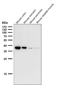 All lanes use the CXCR6 antibody at 1:1000 dilution for 1 hour at room temperature. Predicted molecular weight ~39 kDa.