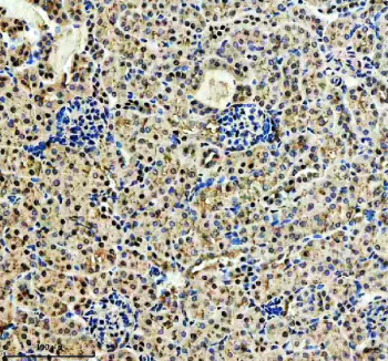 Immunohistochemical staining of CDK2(Phospho-T160)/CDK1(Phospho-T161) using anti-Phospho-CDK2/CDK1 (Thr160/Thr161) antibody. CDK2(Phospho-T160)/CDK1(Phospho-T161) was detected in a paraffin-embedded section of mouse kidney tissue. Heat mediated antigen retrieval was performed in EDTA buffer (pH 8.0, epitope retrieval solution). The tissue section was blocked with 10% goat serum. The tissue section was then incubated with a dilution of 1:50 rabbit anti-Phospho-CDK2/CDK1 (Thr160/Thr161) antibody overnight at 4oC. Peroxidase Conjugated Goat Anti-rabbit IgG was used as secondary antibody and incubated for 30 minutes at 37oC. The tissue section was developed using an HRP secondary and DAB substrate.