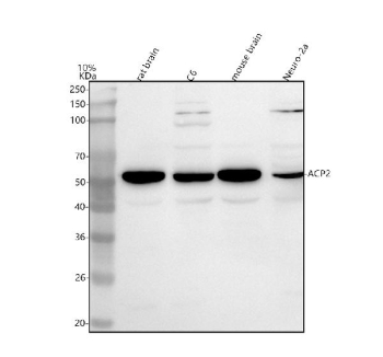Western blot analysis of ACP2 using anti-ACP2 antibody. Lane 1: rat brain tissue lysates, Lane 2: rat C6 whole cell lysates, Lane 3: mouse brain tissue lysates, Lane 4: mouse Neuro-2a whole cell lysates. After electrophoresis, proteins were transferred to a nitrocellulose membrane at 150 mA for 50-90 minutes. Blocked the membrane with 5% non-fat milk/TBS for 1.5 hour at RT. The membrane was incubated with rabbit anti-ACP2 antibody at 0.5 ug/ml overnight at 4oC, then washed with TBS-0.1%Tween 3 times with 5 minutes each and probed with a goat anti-rabbit IgG-HRP secondary antibody at a dilution of 1:5000 for 1.5 hour at RT. The signal was developed using enhanced chemiluminescent. The expected molecular weight of ACP2 is at 48,18 kDa.
