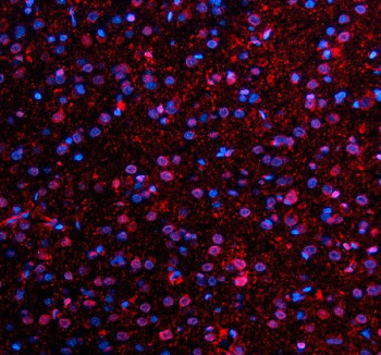 Immunofluorescent staining of NMNAT1 using anti-NMNAT1 antibody (red). NMNAT1 was detected in a paraffin-embedded section of rat brain tissue. Heat mediated antigen retrieval was performed in EDTA buffer (pH 8.0, epitope retrieval solution). The tissue section was blocked with 10% goat serum. The tissue section was then incubated with 5 ug/ml rabbit anti-NMNAT1 antibody overnight at 4oC. Cy3 Conjugated Goat Anti-Rabbit IgG was used as secondary antibody at 1:500 dilution and incubated for 30 minutes at 37oC. The section was counterstained with DAPI nuclear stain (blue). Visualize using a fluorescence microscope and filter sets appropriate for the label used.