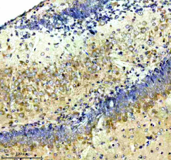 Immunohistochemical staining of NCDN using anti-NCDN antibody. NCDN was detected in a paraffin-embedded section of mouse brain tissue. Heat mediated antigen retrieval was performed in EDTA buffer (pH 8.0, epitope retrieval solution). The tissue section was blocked with 10% goat serum. The tissue section was then incubated with 2 ug/ml rabbit anti-NCDN antibody overnight at 4oC. Peroxidase Conjugated Goat Anti-rabbit IgG was used as secondary antibody and incubated for 30 minutes at 37oC. The tissue section was developed using an HRP secondary and DAB substrate.