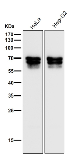 All lanes use the PICALM antibody at 1:3000 dilution for 1 hour at room temperature. Western blot analysis of PICALM using anti-PICALM antibody. A triplet is observed between ~60 and 71 kDa, consistent with reported isoforms and phosphorylation variants of PICALM that arise from alternative splicing and post-translational modification.