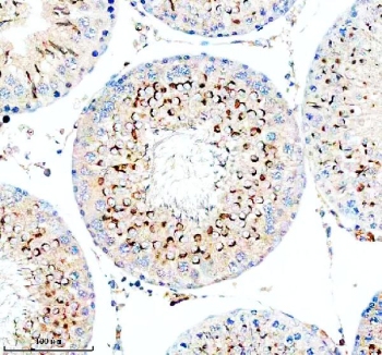 Immunohistochemical staining of TESMIN using anti-TESMIN antibody. TESMIN was detected in a paraffin-embedded section of rat testis tissue. Heat mediated antigen retrieval was performed in EDTA buffer (pH 8.0, epitope retrieval solution). The tissue section was blocked with 10% goat serum. The tissue section was then incubated with 2 ug/ml rabbit anti-TESMIN antibody overnight at 4oC. Peroxidase Conjugated Goat Anti-rabbit IgG was used as secondary antibody and incubated for 30 minutes at 37oC. The tissue section was developed using an HRP secondary and DAB substrate.