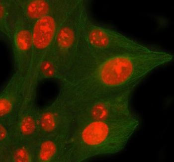 Immunofluorescent staining of CDCA8 using anti-CDCA8 antibody (red) and anti-Beta Tubulin antibody (green). CDCA8 was detected in immunocytochemical section of U2OS cell. Enzyme antigen retrieval was performed using IHC enzyme antigen retrieval reagent for 15 mins. The cells were blocked with 10% goat serum. And then incubated with 5 ug/ml rabbit anti-CDCA8 antibody and mouse anti-Beta Tubulin antibody overnight at 4oC. Cy3 Conjugated Goat Anti-Rabbit IgG and DyLight 488 Conjugated Goat Anti-Mouse IgG were used as secondary antibody at 1:500 dilution and incubated for 30 minutes at 37oC. Visualize using a fluorescence microscope and filter sets appropriate for the label used.