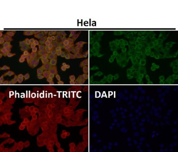 Immunofluorescent analysis using the LAG-3 antibody (green) at 1:150 dilution.