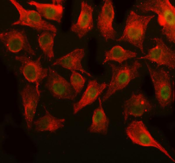 Immunofluorescent staining of OGFOD3 using anti-OGFOD3 antibody (green) and anti-Beta Tubulin antibody (red). OGFOD3 was detected in immunocytochemical section of cell. Enzyme antigen retrieval was performed using IHC enzyme antigen retrieval reagent for 15 mins. The cells were blocked with 10% goat serum. And then incubated with 5 ug/ml rabbit anti-OGFOD3 antibody and mouse anti-Beta Tubulin antibody overnight at 4oC. DyLight 488 Conjugated Goat Anti-Rabbit IgG and DyLight 594 Conjugated Goat Anti-Mouse IgG were used as secondary antibody at 1:500 dilution and incubated for 30 minutes at 37oC. Visualize using a fluorescence microscope and filter sets appropriate for the label used.