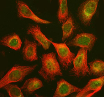 Immunofluorescent staining of CHP2 using anti-CHP2 antibody (green) and anti-Beta Tubulin antibody (red). CHP2 was detected in an immunocytochemical section of Hela cells. Enzyme antigen retrieval was performed using IHC enzyme antigen retrieval reagent for 15 mins. The cells were blocked with 10% goat serum. And then incubated with 5 ug/ml rabbit anti-CHP2 antibody and mouse anti-Beta Tubulin antibody overnight at 4oC. DyLight 488 Conjugated Goat Anti-Rabbit IgG and DyLight 594 Conjugated Goat Anti-Mouse IgG were used as secondary antibody at 1:500 dilution and incubated for 30 minutes at 37oC. Visualize using a fluorescence microscope and filter sets appropriate for the label used.
