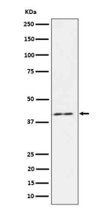 Western blot analysis of IL18 binding protein in human HeLa cell lysate using IL18BP antibody. Expected molecular weight: ~21 kDa unmodified and up to ~45 kDa glycosylated.
