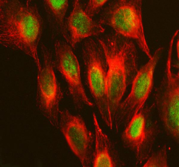 Immunofluorescent staining of RPS19BP1 using anti-RPS19BP1 antibody (green) and anti-Beta Tubulin antibody (red). RPS19BP1 was detected in an immunocytochemical section of U2OS cells. Enzyme antigen retrieval was performed using IHC enzyme antigen retrieval reagent for 15 mins. The cells were blocked with 10% goat serum. And then incubated with 5 ug/ml rabbit anti-RPS19BP1 antibody and mouse anti-Beta Tubulin antibody overnight at 4oC. DyLight 488 Conjugated Goat Anti-Rabbit IgG and Cy3 Conjugated Goat Anti-Mouse IgG were used as secondary antibody at 1:500 dilution and incubated for 30 minutes at 37oC. Visualize using a fluorescence microscope and filter sets appropriate for the label used.