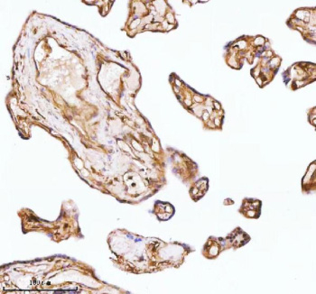 Immunohistochemical staining of GNAI2 using anti-GNAI2 antibody. GNAI2 was detected in a paraffin-embedded section of human placenta tissue. Heat mediated antigen retrieval was performed in EDTA buffer (pH 8.0, epitope retrieval solution). The tissue section was blocked with 10% goat serum. The tissue section was then incubated with 2 ug/ml rabbit anti-GNAI2 antibody overnight at 4oC. Peroxidase Conjugated Goat Anti-rabbit IgG was used as secondary antibody and incubated for 30 minutes at 37oC. The tissue section was developed using an HRP secondary and DAB substrate.