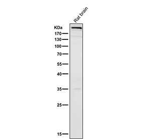 All lanes use the MTOR antibody at 1:500 dilution for 1 hour at room temperature.