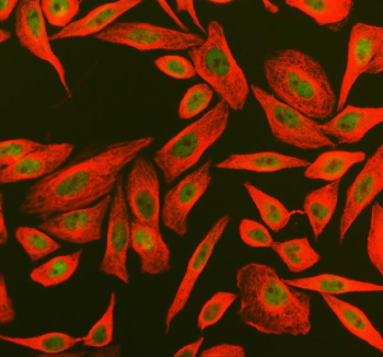 Immunofluorescent staining of PYHIN1 using anti-PYHIN1 antibody (green) and Alpha Tubulin mAb (red). PYHIN1 was detected in an immunocytochemical section of SiHa cells. Enzyme antigen retrieval was performed using IHC enzyme antigen retrieval reagent for 15 mins. The cells were blocked with 10% goat serum.