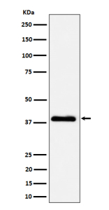 Western blot analysis of NSDHL expression in A431 cell lysate using NSDHL antibody. NSDHL is an ER-associated membrane protein that typically migrates faster on SDS-PAGE due to signal peptide cleavage and altered SDS binding and is commonly observed at ~38 kDa.