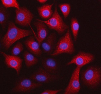 Immunofluorescent staining of STOML3 using anti-STOML3 antibody. STOML3 was detected in an immunocytochemical section of cells. Enzyme antigen retrieval was performed using IHC enzyme antigen retrieval reagent for 15 mins. The cells were blocked with 10% goat serum. And then incubated with 5 ug/ml rabbit anti-STOML3 antibody overnight at 4oC. Cy3 Conjugated Goat Anti-Rabbit IgG was used as secondary antibody at 1:500 dilution and incubated for 30 minutes at 37oC. The section was counterstained with DAPI nuclear stain (blue). Visualize using a fluorescence microscope and filter sets appropriate for the label used.