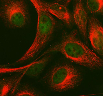 Immunofluorescent staining of FFPE human HeLa cells with MAML1 antibody (green) and Alpha Tubulin mAb (red). HIER: steam section in pH6 citrate buffer for 20 min.