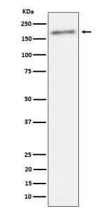 Western blot analysis of Phospho-ErbB2(Y1221 + Y1222) expression in human SKBR3 cell lysate using Phospho-ErbB2 (Tyr1221/Tyr1222) antibody. A single band is detected at approximately 190â200 kDa, consistent with the phosphorylated, full-length form of the ErbB2/HER2 receptor.