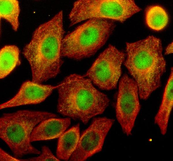Immunofluorescent staining of OSTM1 using anti-OSTM1 antibody (green) and anti-Beta Tubulin antibody (red). OSTM1 was detected in an immunocytochemical section of human SIHA cells. Enzyme antigen retrieval was performed using IHC enzyme antigen retrieval reagent for 15 mins. The cells were blocked with 10% goat serum. And then incubated with 5 ug/ml rabbit anti-OSTM1 antibody and mouse anti-Beta Tubulin antibody overnight at 4oC. DyLight 488 Conjugated Goat Anti-Rabbit IgG and Cy3 Conjugated Goat Anti-Mouse IgG were used as secondary antibody at 1:500 dilution and incubated for 30 minutes at 37oC. Visualize using a fluorescence microscope and filter sets appropriate for the label used.