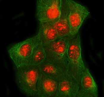 Immunofluorescent staining of SPIDR using anti-SPIDR antibody and anti-Beta Tubulin antibody. SPIDR was detected in immunocytochemical section of U2OS cell. Enzyme antigen retrieval was performed using IHC enzyme antigen retrieval reagent for 15 mins. The cells were blocked with 10% goat serum. And then incubated with 5 ug/ml rabbit anti-SPIDR antibody and mouse anti-Beta Tubulin antibody overnight at 4oC. Cy3 Conjugated Goat Anti-Rabbit IgG and FITC Conjugated Goat Anti-Mouse IgG were used as secondary antibody at 1:500 dilution and incubated for 30 minutes at 37oC. Visualize using a fluorescence microscope and filter sets appropriate for the label used.
