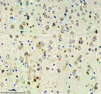 Immunohistochemical staining of RIM1/RIMS1 using anti-RIMS1 antibody. RIM1/RIMS1 was detected in a paraffin-embedded section of mouse brain tissue. Heat mediated antigen retrieval was performed in EDTA buffer (pH 8.0, epitope retrieval solution). The tissue section was blocked with 10% goat serum. The tissue section was then incubated with 2 ug/ml rabbit anti-RIMS1 antibody overnight at 4oC. Peroxidase Conjugated Goat Anti-rabbit IgG was used as secondary antibody and incubated for 30 minutes at 37oC. The tissue section was developed using an HRP secondary and DAB substrate.