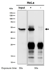 Immunoprecipitation analysis using the ACTR1B antibody at 1:50 dilution. Western blot at 1:500 dilution, predicted molecular weight ~45 kDa.