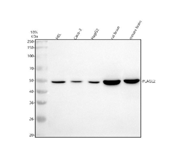 Western blot analysis of PLAGL2 using anti-PLAGL2 antibody. Electrophoresis was performed on a 10% SDS-PAGE gel at 80V (Stacking gel) / 120V (Resolving gel) for 2 hours. Lane 1: human HEL whole cell lysates, Lane 2: human Caco-2 whole cell lysates, Lane 3: human HepG2 whole cell lysates, Lane 4: rat brain tissue lysates, Lane 5: mouse brain tissue lysates. After electrophoresis, proteins were transferred to a nitrocellulose membrane at 150 mA for 50-90 minutes. Blocked the membrane with 5% non-fat milk/TBS for 1.5 hour at RT. The membrane was incubated with rabbit anti-PLAGL2 antibody at 0.5 ug/ml overnight at 4oC, then washed with TBS-0.1%Tween 3 times with 5 minutes each and probed with a goat anti-rabbit IgG-HRP secondary antibody at a dilution of 1:5000 for 1.5 hour at RT. The signal was developed using an ECL Plus Western Blotting Substrate. A predominant band is detected near ~49 kDa, consistent with the known faster SDS-PAGE migration of the ~55 kDa PLAGL2 zinc-finger transcription factor.