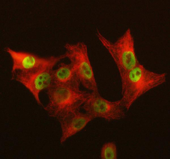 Immunofluorescent staining of GALNT12 using anti-GALNT12 antibody (green) and anti-Beta Tubulin antibody (red). GALNT12 was detected in immunocytochemical section of cell. Enzyme antigen retrieval was performed using IHC enzyme antigen retrieval reagent for 15 mins. The cells were blocked with 10% goat serum. And then incubated with 5 ug/ml rabbit anti-GALNT12 antibody and mouse anti-Beta Tubulin antibody overnight at 4oC. DyLight 488 Conjugated Goat Anti-Rabbit IgG and Cy3 Conjugated Goat Anti-Mouse IgG were used as secondary antibody at 1:500 dilution and incubated for 30 minutes at 37oC. Visualize using a fluorescence microscope and filter sets appropriate for the label used.