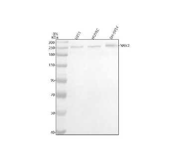 Western blot analysis of NAV3 using anti-NAV3 antibody. Lane 1: human U251 whole cell lysates, Lane 2: human HUVEC whole cell lysates, Lane 3: human SH-SY5Y whole cell lysates. After electrophoresis, proteins were transferred to a nitrocellulose membrane at 150 mA for 50-90 minutes. Blocked the membrane with 5% non-fat milk/TBS for 1.5 hour at RT. The membrane was incubated with rabbit anti-NAV3 antibody at 0.5 ug/ml overnight at 4oC, then washed with TBS-0.1%Tween 3 times with 5 minutes each and probed with a goat anti-rabbit IgG-HRP secondary antibody at a dilution of 1:5000 for 1.5 hour at RT. The signal was developed using enhanced chemiluminescent. A specific band was detected for NAV3 at approximately 256 kDa. The expected molecular weight of NAV3 is ~256 kDa.