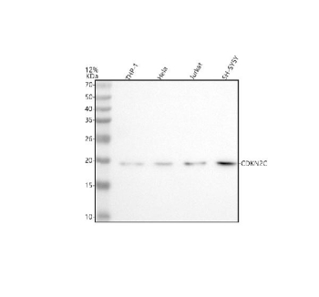Western blot analysis of CDKN2C using anti-CDKN2C antibody. Lane 1: human THP-1 whole cell lysates, Lane 2: human Hela whole cell lysates, Lane 3: human Jurkat whole cell lysates, Lane 4: human SH-SY5Y whole cell lysates. After electrophoresis, proteins were transferred to a nitrocellulose membrane at 150 mA for 50-90 minutes. Blocked the membrane with 5% non-fat milk/TBS for 1.5 hour at RT. The membrane was incubated with rabbit anti-CDKN2C antibody at 0.5 ug/ml overnight at 4oC, then washed with TBS-0.1%Tween 3 times with 5 minutes each and probed with a goat anti-rabbit IgG-HRP secondary antibody at a dilution of 1:5000 for 1.5 hour at RT. The signal was developed using enhanced chemiluminescent. A specific band was detected for CDKN2C at approximately 18 kDa. The expected molecular weight of CDKN2C is ~18 kDa.