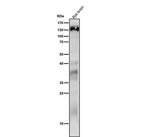 Western blot analysis of Delta 2 Catenin expression in rat brain cell lysate using CTNND2 antibody. Predicted molecular weight ~133 kDa.