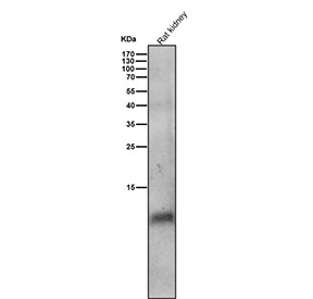 Rat kidney tissue lysate tested with the Phospho-Phospholamban (S16) antibody at 1:2000 dilution for 1 hour at room temperature. A specific band is detected near ~10 kDa, consistent with the phosphorylated form of monomeric Phospholamban. The apparent size exceeds its 6 kDa theoretical mass due to its hydrophobic, multimeric nature and phosphorylation-dependent gel mobility.