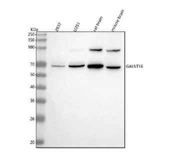 Western blot analysis of GALNT16 using anti-GALNT16 antibody. Lane 1: human 293T whole cell lysates, Lane 2: human U251 whole cell lysates, Lane 3: rat brain tissue lysates, Lane 4: mouse brain tissue lysates. After electrophoresis, proteins were transferred to a nitrocellulose membrane at 150 mA for 50-90 minutes. Blocked the membrane with 5% non-fat milk/TBS for 1.5 hour at RT. The membrane was incubated with rabbit anti-GALNT16 antibody at 0.5 ug/ml overnight at 4oC, then washed with TBS-0.1%Tween 3 times with 5 minutes each and probed with a goat anti-rabbit IgG-HRP secondary antibody at a dilution of 1:5000 for 1.5 hour at RT. The signal was developed using enhanced chemiluminescent. GALNT16 western blot across human cell lines and rodent brain shows the expected band near ~65-70 kDa and an additional ~90 kDa band that is prominent in brain. The upper species likely represents a more heavily glycosylated and/or oligomeric form of GALNT16, consistent with known processing and complex formation of ppGalNAc-T family glycosyltransferases.