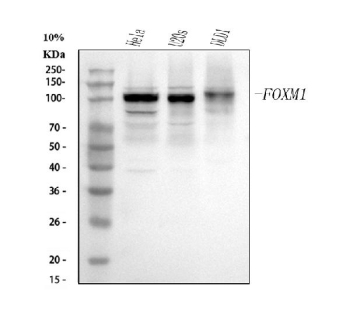 Western blot analysis of FOXM1 using anti-FOXM1 antibody. Electrophoresis was performed on a 12% SDS-PAGE gel at 80V (Stacking gel) / 120V (Resolving gel) for 2 hours. Lane 1: human Hela whole cell lysates, Lane 2: human U2OS whole cell lysates, Lane 3: human DLD1 whole cell lysates. After electrophoresis, proteins were transferred to a nitrocellulose membrane at 150 mA for 50-90 minutes. Blocked the membrane with 5% non-fat milk/TBS for 1.5 hour at RT. The membrane was incubated with rabbit anti-FOXM1 antibody at 0.5 ug/ml overnight at 4oC, then washed with TBS-0.1%Tween 3 times with 5 minutes each and probed with a goat anti-rabbit IgG-HRP secondary antibody at a dilution of 1:5000 for 1.5 hour at RT. The signal was developed using an ECL Plus Western Blotting Substrate. Major bands between ~85-105 kDa correspond to FOXM1 isoforms and phosphorylation states. The multiple closely spaced bands represent differentially phosphorylated forms of FOXM1, consistent with its activation during the G2/M phase of the cell cycle.