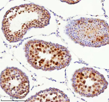Immunohistochemical staining of BCCIP using anti-BCCIP antibody. BCCIP was detected in a paraffin-embedded section of rat testis tissue. Heat mediated antigen retrieval was performed in EDTA buffer (pH 8.0, epitope retrieval solution). The tissue section was blocked with 10% goat serum. The tissue section was then incubated with 2 ug/ml rabbit anti-BCCIP antibody overnight at 4oC. Peroxidase Conjugated Goat Anti-rabbit IgG was used as secondary antibody and incubated for 30 minutes at 37oC. The tissue section was developed using an HRP secondary and DAB substrate.